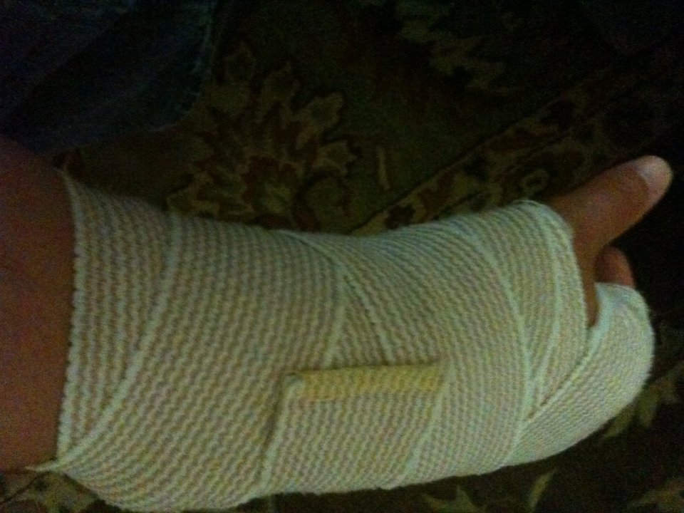 Emergency Room Splint